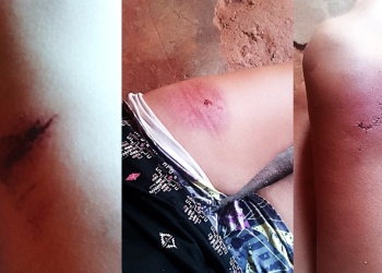 Asaltan a niños cuando salen de la escuela y la policía no responde si no hay denuncia