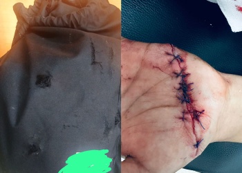 Oberá: una patota macheteó y golpeó a cuatro estudiantes