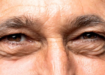 Blefaroplastia: cuando la cirugía de párpados deja de ser solo estética