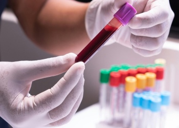 Buscan detectar el cáncer con un solo análisis de sangre