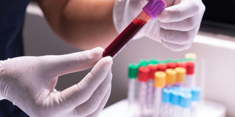 AVANCE. El desarrollo promete mejorar los tiempos de diagnóstico.