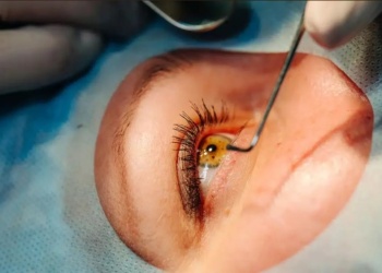 Misiones, clave en la red solidaria que reduce la ceguera en el país