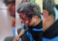 Un hombre terminó herido en la cabeza tras una pelea entre vecinos en Posadas