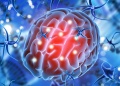 Tras 20 años, un nuevo tratamiento para gliomas llega a la Argentina