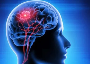 Tumores cerebrales: destacan la importancia de consultar ante cambios neurológicos o conductuales