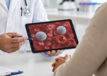 El 89% de los pacientes no asoció sus síntomas iniciales con la leucemia