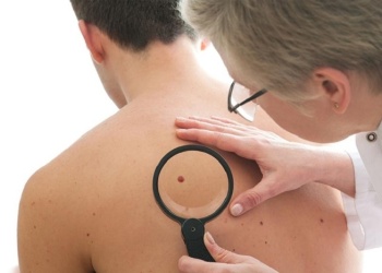 Cáncer de Piel: “Queremos enseñar al paciente cómo cuidarse y cuáles son las pautas de alarma”
