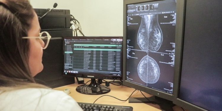 DETECTAR A TIEMPO. El estudio mejora drásticamente la detección del cáncer de mama en estadios tempranos.